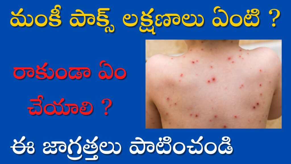 Monkey Pox Symptoms In Telugu